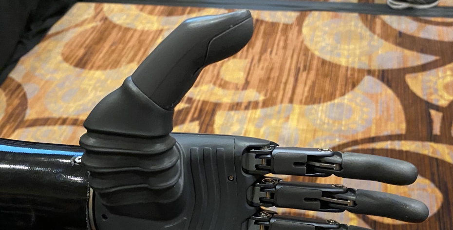You can move this prosthetic hand with your mind