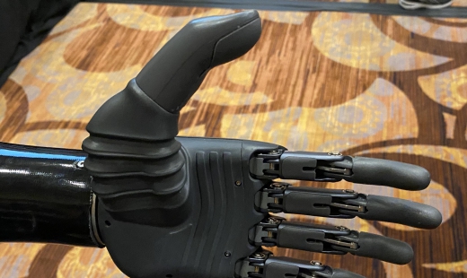 You can move this prosthetic hand with your mind