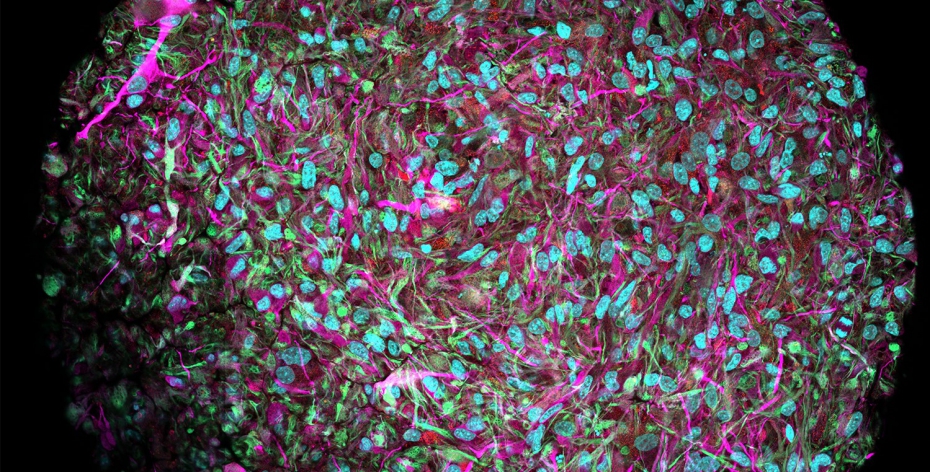 AI Could Be Made Obsolete by 'Biocomputers' Running on Human Brain Cells