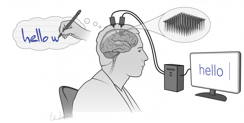 Brain implants let paralyzed man write on a screen using thoughts alone