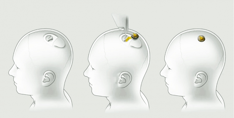 Elon Musk Says a Neuralink Update Is Coming on Halloween