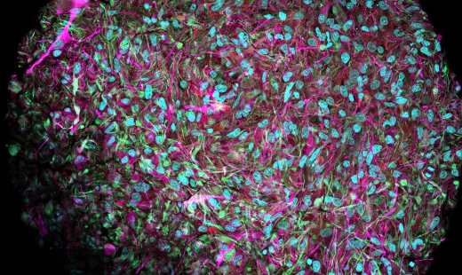 AI Could Be Made Obsolete by 'Biocomputers' Running on Human Brain Cells