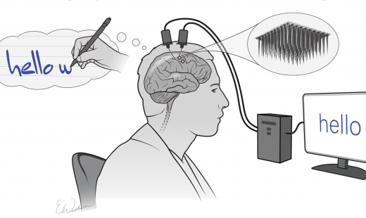 Brain implants let paralyzed man write on a screen using thoughts alone