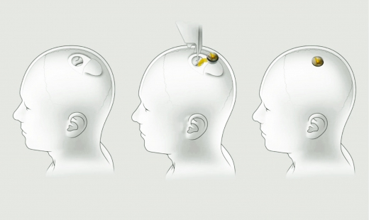 Elon Musk Says a Neuralink Update Is Coming on Halloween